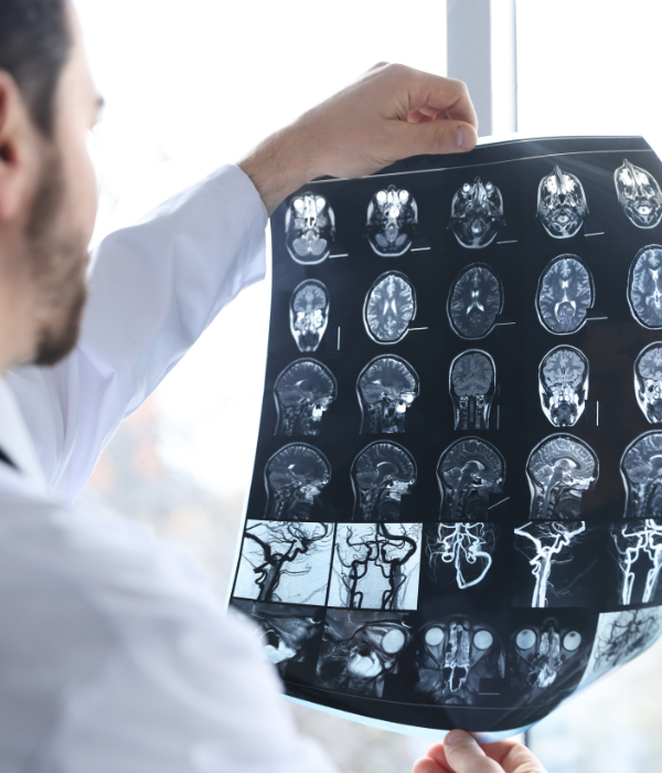 Brain Aneurysm Treatment