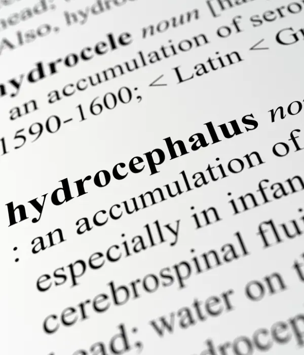 Hydrocephalus Treatment
