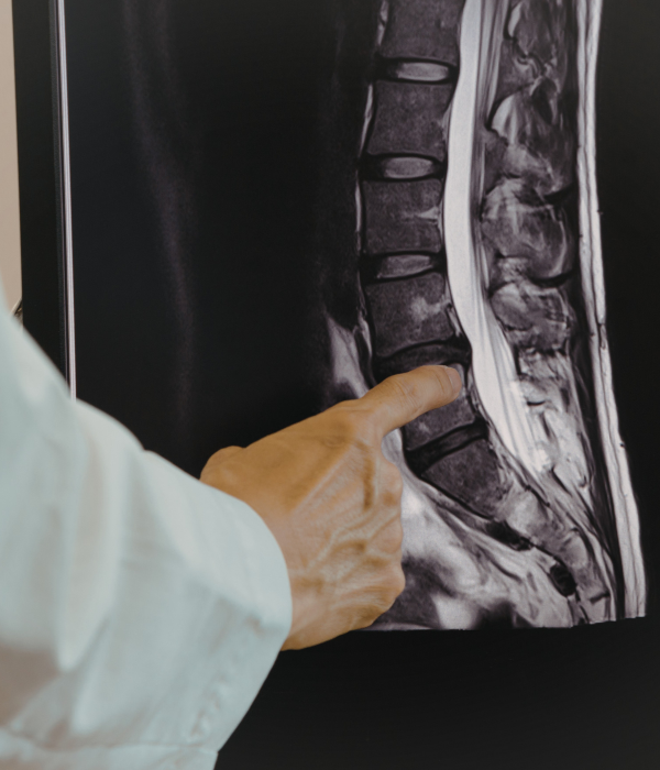 Spinal Tumour Treatment