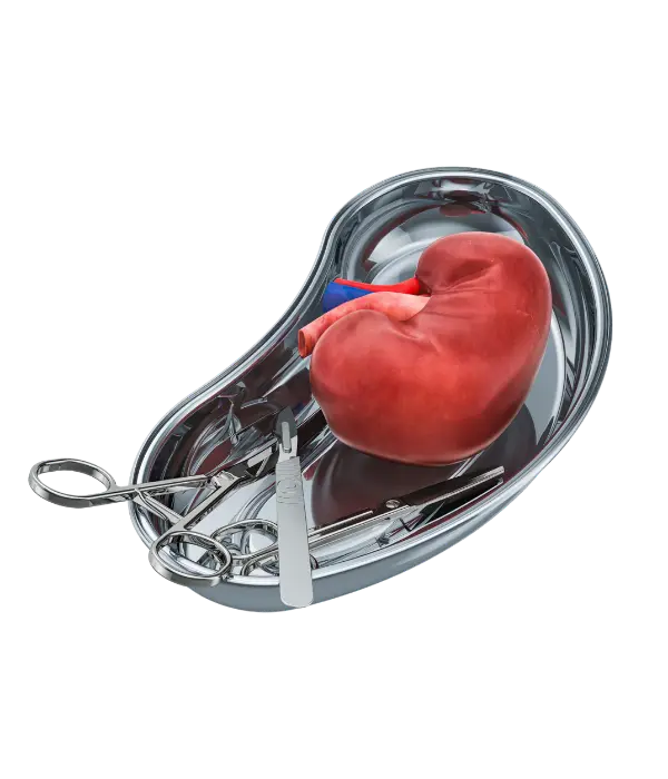 Gall bladder stone surgery showing gallstones in gallbladder and laparoscopic removal procedure