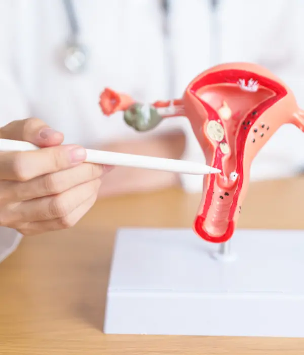 Ovarian cyst treatment showing ovary with cyst and ultrasound diagnosis for women health