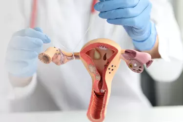 Female Contraception
