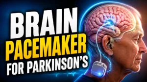 Deep Brain Stimulation Kya Hai