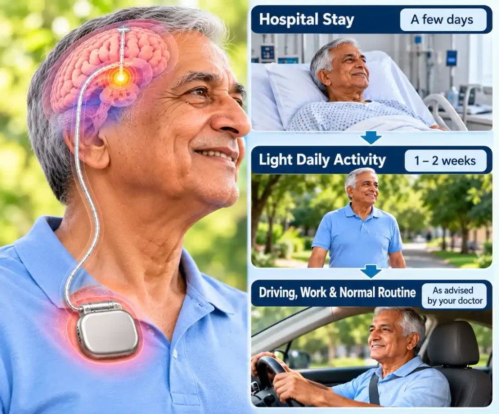 Medical infographic showing recovery after DBS surgery, including hospital stay, return to daily activities, and rechargeable versus non-rechargeable neurostimulator batteries.